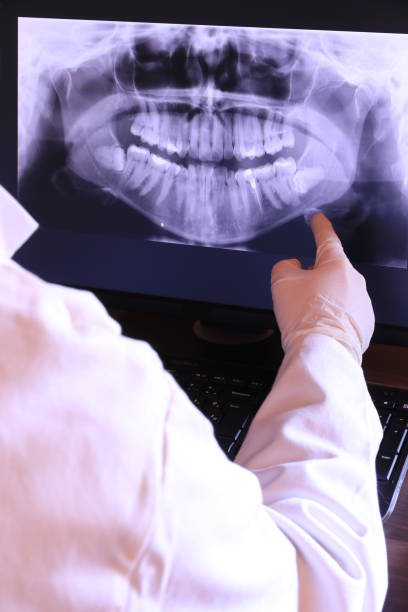 Best Emergency Treatment for Dental Infections or Abscesses in Lake Shore, MD